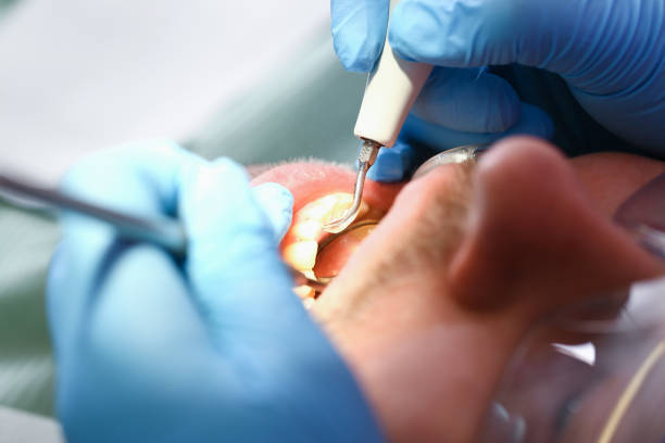 Best Walk-In Emergency Dentist in Olmos Park, TX