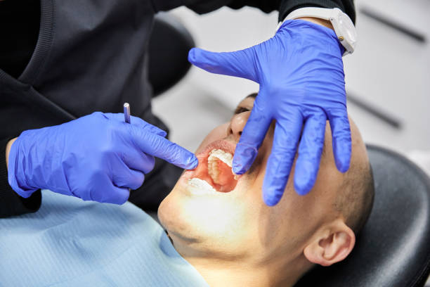 Best Emergency Tooth Extraction in Olmos Park, TX